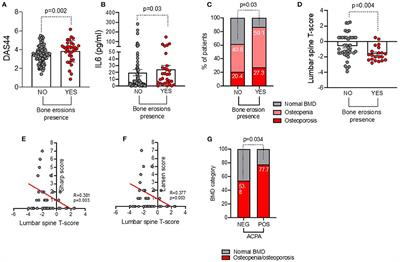 Systemic Bone Density at Disease Onset Is Associated With Joint Erosion Progression in Early Naive to Treatment Rheumatoid Arthritis: A Prospective 12-Month Follow-Up Open-Label Study